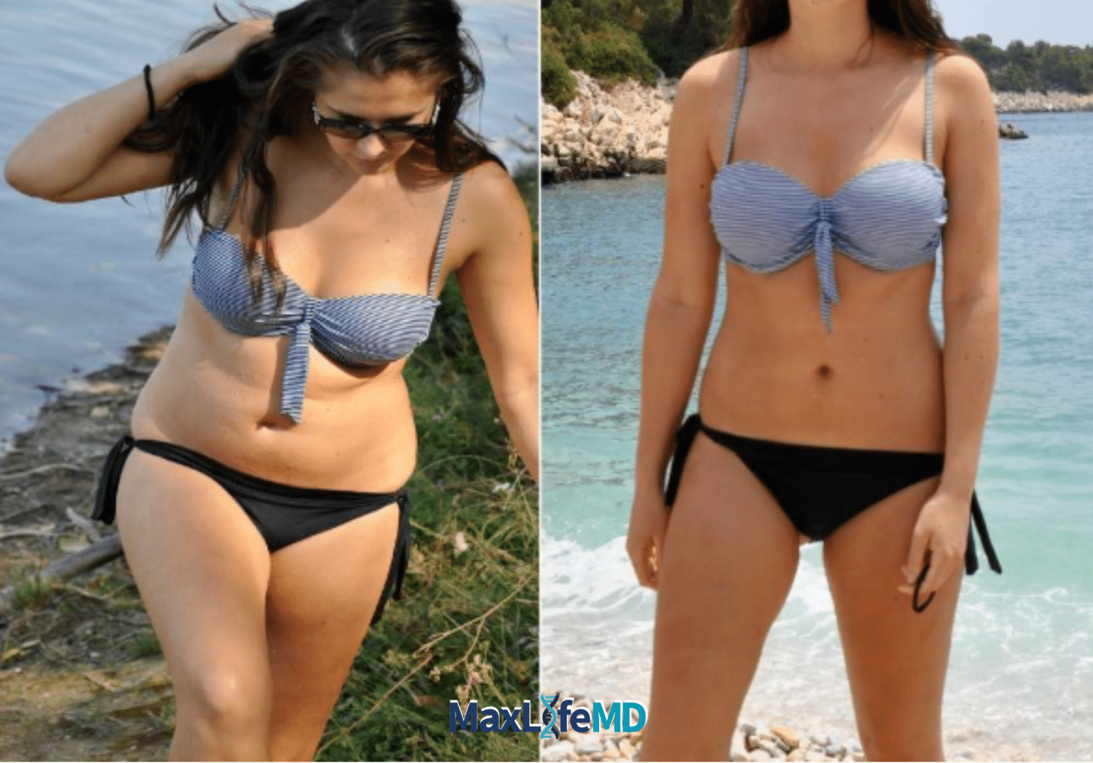 MaxLife MD Website GLP1 Tirzepatide NAD Energy Lose Weight Lose Fat Women 1